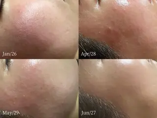 lymph care 'Welnəsのエステ・リラクイメージ