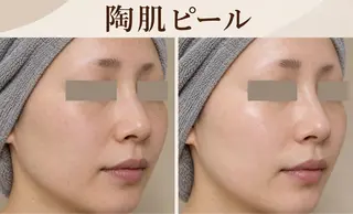 トラブル肌改善🏥 Meow！🫧🫧のエステ・リラクイメージ