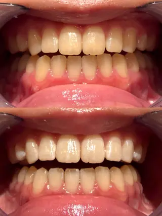 écrusmile ホワイトニングサロンのその他イメージ