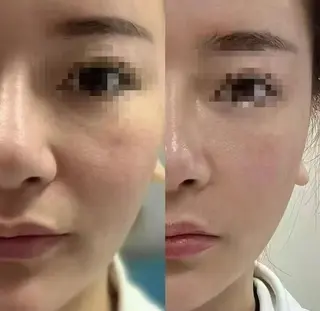 ネイル 愛維美水光専門店 川崎彩鳳のエステ・リラクイメージ