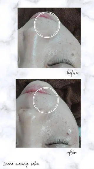 Luana wax 🐚根本のエステ・リラクイメージ