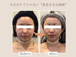 小顔FaceLabo 姫路店のエステ・リラクイメージ