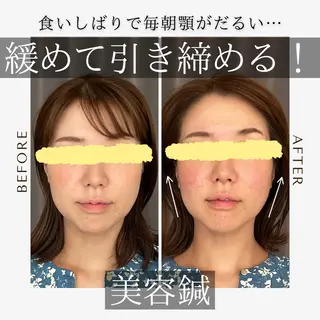 《美肌・小顔》美容鍼 &マッサージ*MEIのエステ・リラクイメージ