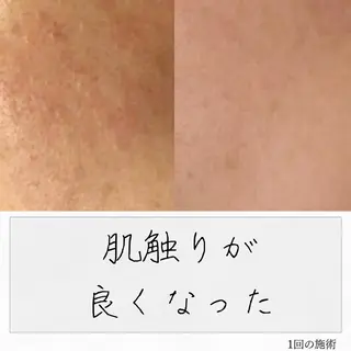 ニキビ経験者が施術 する専門サロン🌻のエステ・リラクイメージ
