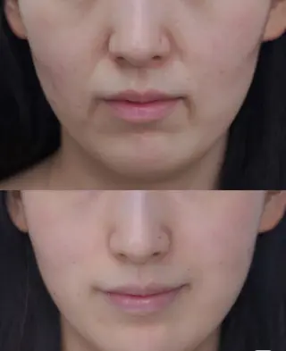 マツエク・マツパ 愛維美水光専門店 川崎彩鳳のエステ・リラクイメージ