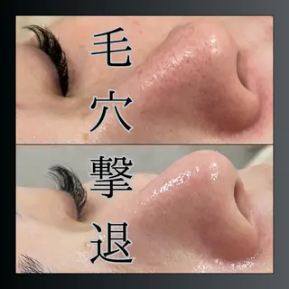 LiZA エステティックサロンのエステ・リラクイメージ