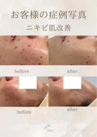 pansy フェイシャルエステのエステ・リラクイメージ