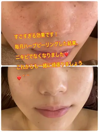 ❤️予約殺到❤️mi オールハンド痩身専門のエステ・リラクイメージ