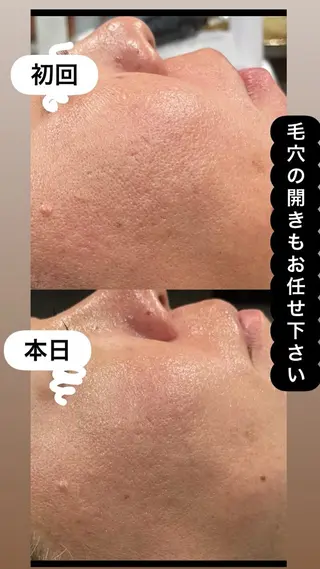 LiZA エステティックサロンのエステ・リラクイメージ