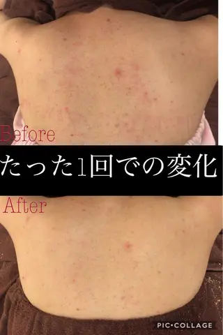 ミディアム カラー パーマ ヘアアレンジ メンズ キッズ ネイル マツエク・マツパ ニキビ・肌質改善専門 ♡人生が変わるサロンのエステ・リラクイメージ