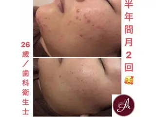 ミディアム カラー パーマ ヘアアレンジ メンズ キッズ ネイル マツエク・マツパ ニキビ・肌質改善専門 ♡人生が変わるサロンのエステ・リラクイメージ
