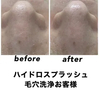 ネイル・エステサロン UILANIのエステ・リラクイメージ