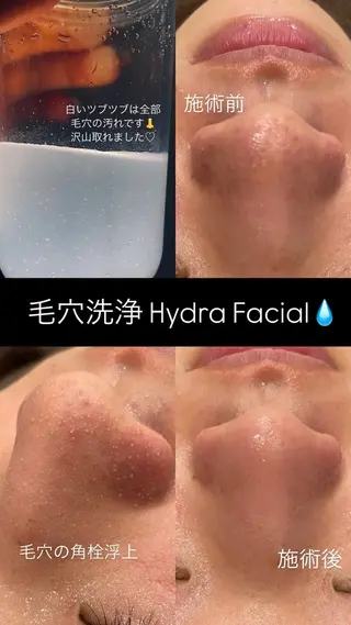 Firstclass Erikaのエステ・リラクイメージ
