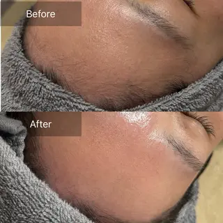 enine フェイスWAXのエステ・リラクイメージ
