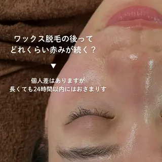 顔ワックス脱毛/ ハーブピーリングのエステ・リラクイメージ