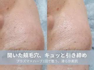 La chic.のエステ・リラクイメージ