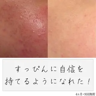 ニキビ経験者が施術 する専門サロン🌻のエステ・リラクイメージ
