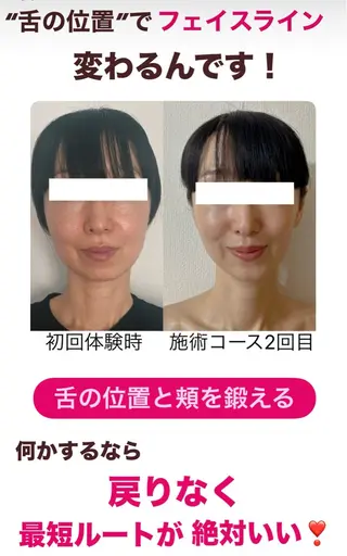 小顔サロン (ラ リュミエール)のエステ・リラクイメージ