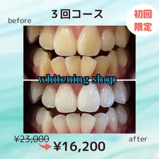 ホワイトニング ショップ葛西店のその他イメージ