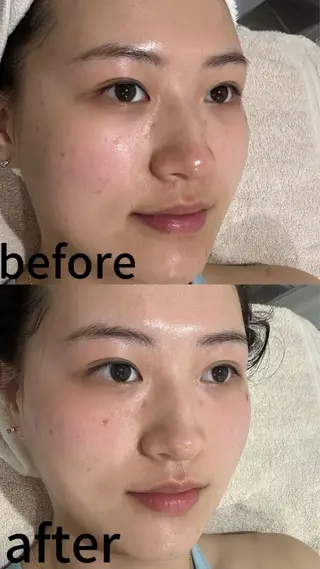 ネイル 愛維美水光専門店 川崎彩鳳のエステ・リラクイメージ