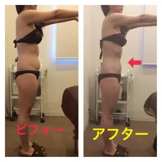 バストアップ・痩身 エステプレジィールのエステ・リラクイメージ