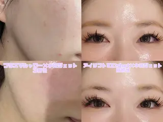 マツエク・マツパ 愛維美水光美肌専門店 メンズレディースokのエステ・リラクイメージ
