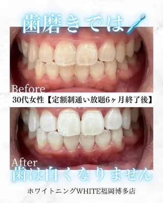 キッズ メンズ セルフホワイトニング WHITE福岡博多店のエステ・リラクイメージ