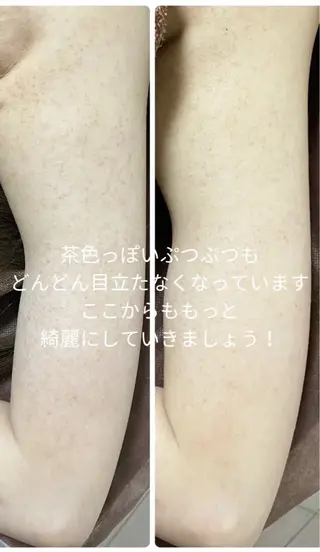 美肌❤️美眉 結果重視サロン✨のエステ・リラクイメージ