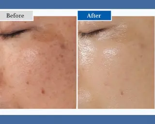 Salon💫 Lino'a柏店のエステ・リラクイメージ