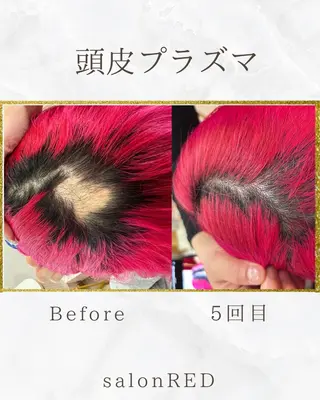 WAX・肌質改善・毛 穴洗浄/林愛真のエステ・リラクイメージ