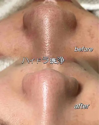 🧚♀️優来 リラク痩身肌質改善のエステ・リラクイメージ