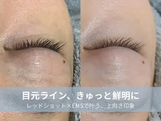 La chic.のエステ・リラクイメージ