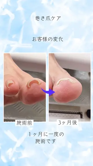 ネイル and Lilyのネイルデザイン