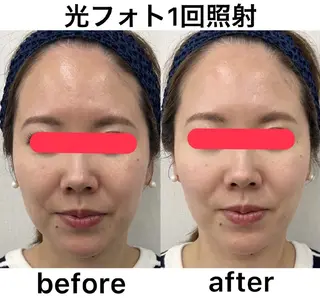 メンズ salonde ReGodのエステ・リラクイメージ