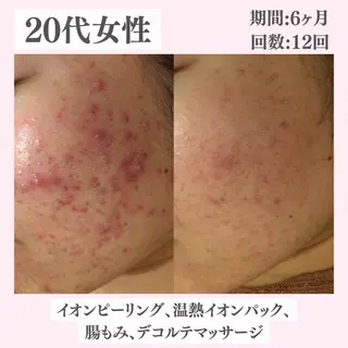 ニキビ・肌質改善専門 ♡人生が変わるサロンのエステ・リラクイメージ