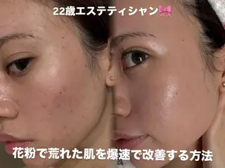 艶肌デトックス🫧 Samiraのエステ・リラクイメージ