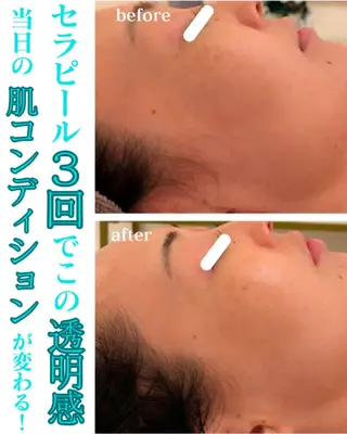 たるみ・ くすみ シミ・ニキビ肌改善のエステ・リラクイメージ