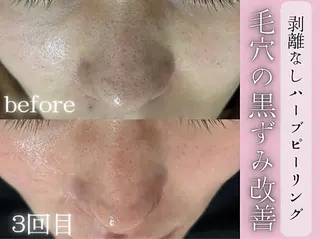 志倉 星来のエステ・リラクイメージ