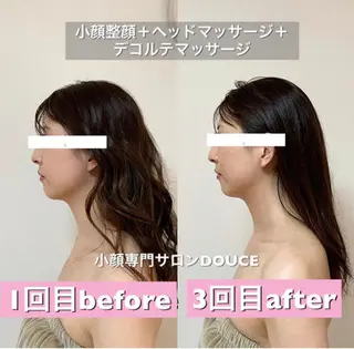 小顔＆美肌 Re :setのエステ・リラクイメージ