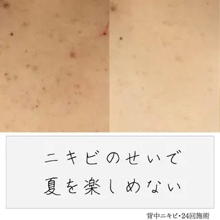ニキビ経験者が施術 する専門サロン🌻のエステ・リラクイメージ