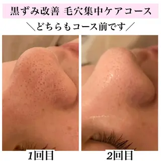Bellesthe (ベルエステ)のエステ・リラクイメージ