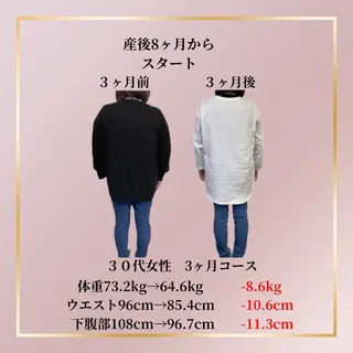 ニキビ体質改善 ダイエット専門店のエステ・リラクイメージ