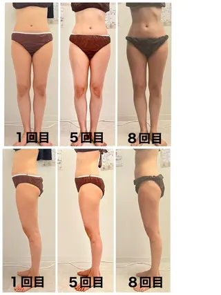 salon ray 痩身／体質改善のエステ・リラクイメージ