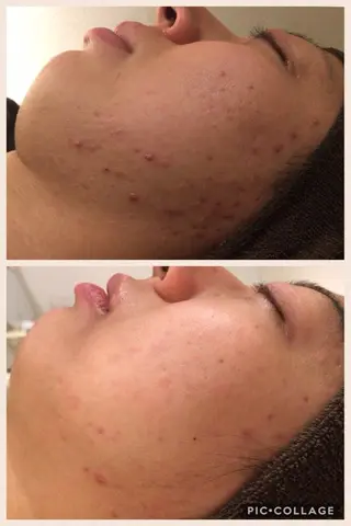 ミディアム カラー パーマ ヘアアレンジ メンズ キッズ ネイル マツエク・マツパ ニキビ・肌質改善専門 ♡人生が変わるサロンのエステ・リラクイメージ