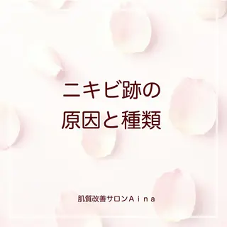 セミロング カラー パーマ ヘアアレンジ メンズ キッズ ネイル マツエク・マツパ ニキビ跡専門サロン Ainaのエステ・リラクイメージ