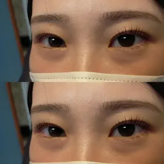 マツエク・マツパ ノア 綾瀬の眉毛・アイブロウイメージ
