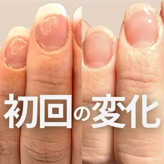 ネイル Tolano nailcareのネイルデザイン