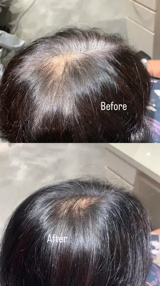 カラー :)) Konoha⋆。˚✩のヘアスタイル
