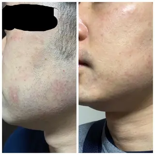 メンズ jonny's beautyのエステ・リラクイメージ