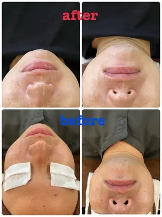 🌺痩身・育乳・ 脱毛サロン/コオリナのエステ・リラクイメージ